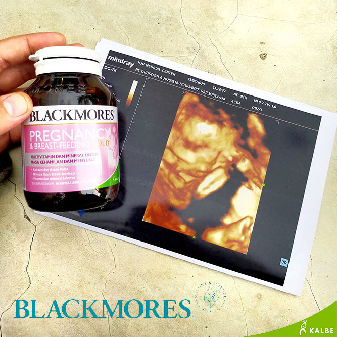vitamin ibu menyusui blackmores uchy sudhanto